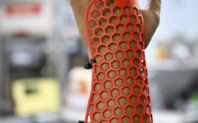 Con las impresoras 3D de la universidad y las propias, tres estudiantes y una egresada de la licenciatura en Ingeniería Biomédica fabricaron más de 70 férulas que fueron enviadas al país suramericano tras los terremotos del 24 de junio